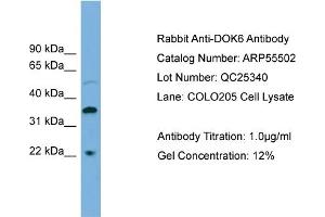 WB Suggested Anti-DOK6  Antibody Titration: 0. (DOK6 anticorps  (Middle Region))