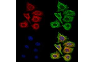 ABIN7094814 and ABIN7098865 staining Hela cells by IF/ICC. (Filaggrin anticorps  (C-Term))
