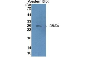 Detection of Recombinant HMGCS2, Human using Polyclonal Antibody to Hydroxymethylglutaryl Coenzyme A Synthase 2, Mitochondrial (HMGCS2) (Hydroxymethylglutaryl Coenzyme A Synthase 2, Mitochondrial (AA 1-167) anticorps)