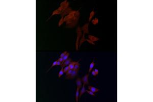 Immunofluorescence analysis of NIH/3T3 cells using  Rabbit pAb (ABIN3016805, ABIN3016806, ABIN3016807 and ABIN6219845) at dilution of 1:100. (ADAMTS5 anticorps  (AA 731-930))