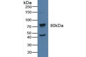 Figure. (beta-Adrenergic Receptor Kinase (AA 398-640) anticorps)