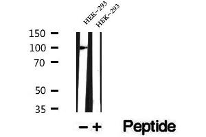 Western blot analysis of extracts of HEK-293, using CTNNA3 antibody. (CTNNA3 anticorps  (Internal Region))