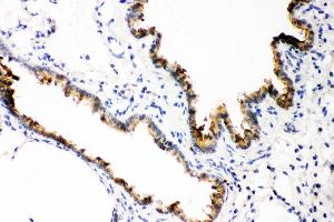 Anti- GST3/GST pi Picoband antibody, IHC(P) IHC(P): Rat Lung Tissue