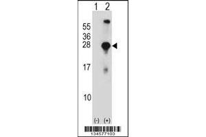 Western blot analysis of SNAP23 using rabbit polyclonal SNAP23 Antibody using 293 cell lysates (2 ug/lane) either nontransfected (Lane 1) or transiently transfected (Lane 2) with the SNAP23 gene.