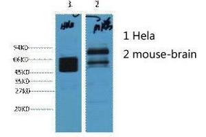 Western Blot (WB) analysis of 1) HeLa, 2) Mouse Brain, diluted at 1:4000. (KRT8 anticorps)