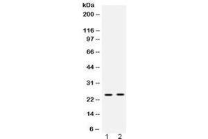 Western blot testing of 1) rat liver and 2) human placenta lysate with HMGB2 antibody at 0. (HMGB2 anticorps)