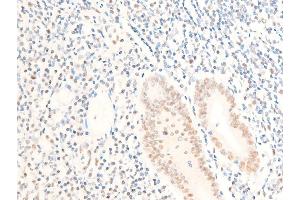 ABIN6267271 at 1/100 staining human appendiceal tissue sections by IHC-P.