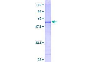 Image no. 1 for AKT Interacting Protein (AKTIP) (AA 1-292) protein (GST tag) (ABIN1344791)