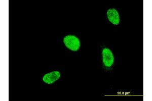 Immunofluorescence of monoclonal antibody to HOXA5 on HeLa cell.