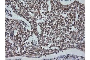 Image no. 9 for anti-V-Ets Erythroblastosis Virus E26 Oncogene Homolog 2 (ETS2) (AA 90-349) antibody (ABIN1491702) (ETS2 anticorps  (AA 90-349))