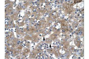 Image no. 1 for anti-Zinc Finger Protein 81 (ZNF81) (C-Term) antibody (ABIN202859)