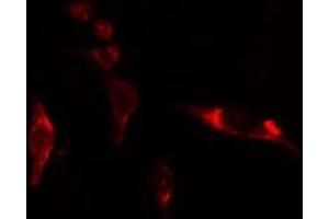 ABIN6275122 staining NIH-3T3 cells by IF/ICC. (EIF3D anticorps  (Internal Region))