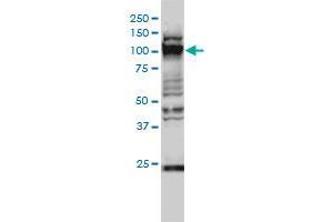 GTF3C2 monoclonal antibody (M01), clone 1C6-2B8 Western Blot analysis of GTF3C2 expression in Hela S3 NE . (GTF3C2 anticorps  (AA 1-911))