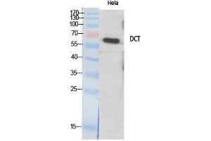 Western Blotting (WB) image for anti-Dopachrome Tautomerase (DCT) (Internal Region) antibody (ABIN3177806) (DCT anticorps  (Internal Region))