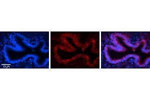 Rabbit Anti-RPLP0 Antibody     Formalin Fixed Paraffin Embedded Tissue: Human Bronchial Epithelial Tissue  Observed Staining: Cytoplasmic  Primary Antibody Concentration: 1:100  Secondary Antibody: Donkey anti-Rabbit-Cy3  Secondary Antibody Concentration: 1:200  Magnification: 20X  Exposure Time: 0.