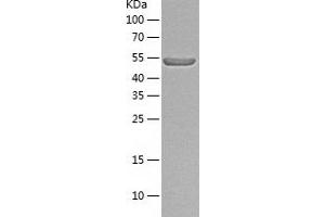 Western Blotting (WB) image for V-Yes-1 Yamaguchi Sarcoma Viral Related Oncogene Homolog (LYN) (AA 2-512) protein (His-IF2DI Tag) (ABIN7125687)