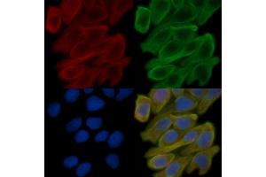 ABIN6258746 and ABIN6273920 staining Hela cells(30 min of UV treatment) by IF/ICC. (FZD10 anticorps)