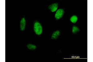 Immunofluorescence of purified MaxPab antibody to ID1 on HeLa cell.