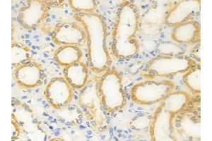 ABIN6263558 and ABIN6277573 at 1/100 staining human normal kidney tissue by IHC-P. (NDUFA13 anticorps  (N-Term))