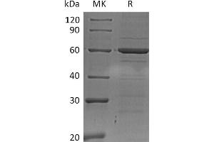 Greater than 95 % as determined by reducing SDS-PAGE.