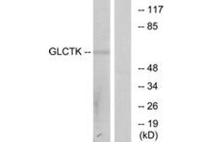 Western blot analysis of extracts from NIH-3T3 cells, using GLCTK Antibody. (GLYCTK anticorps  (AA 101-150))