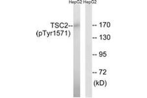 Western Blotting (WB) image for anti-Tuberous Sclerosis 2 (TSC2) (AA 1537-1586), (pTyr1571) antibody (ABIN1532185) (Tuberin anticorps  (pTyr1571))