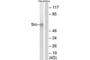 Western blot analysis of extracts from HeLa cells, using Src (Ab-529) Antibody.