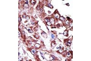 Image no. 2 for anti-Nucleoside Diphosphate Kinase (NME7) (N-Term) antibody (ABIN360548) (NME7 anticorps  (N-Term))