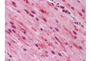 Immunohistochemical analysis of paraffin-embedded human Small Intestine, muscularis propria tissues using anti-GATA3 mouse mAb