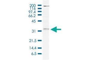 Western Blot (Cell lysate) analysis of 20 ug nuclear extracts of HeLa cells. (WDR61 anticorps)