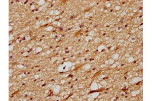 IHC image of ABIN7149649 diluted at 1:700 and staining in paraffin-embedded human brain tissue performed on a Leica BondTM system.