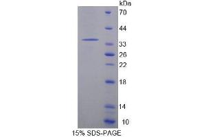 SDS-PAGE analysis of Mouse ACADM Protein.