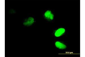 Immunofluorescence of monoclonal antibody to FRG1 on HeLa cell. (FRG1 anticorps  (AA 1-258))