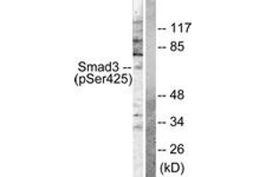 Western blot analysis of extracts from NIH-3T3 cells treated with IGF-I 100ng/ml 10', using Smad3 (Phospho-Ser425) Antibody.