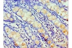 Immunohistochemistry of paraffin-embedded human colon tissue using ABIN7155257 at dilution of 1:100