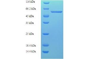 CAPSD (AA 228-781) protein (His tag)