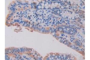 Detection of HEXb in Mouse Small intestine Tissue using Polyclonal Antibody to Hexosaminidase B Beta (HEXb) (HEXB anticorps  (AA 294-435))