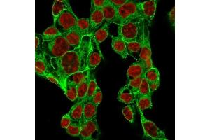 Immunofluorescence Analysis of MeOH-fixed HepG2 cells labeling Glypican-3 with Glypican-3 Rabbit Recombinant Monoclonal Antibody (GPC3/1534R) followed by Goat anti-rabbit IgG-CF488 (Green).