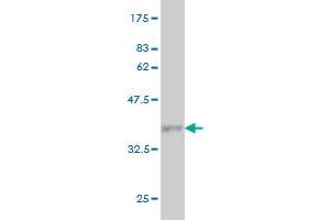 Western Blot detection against Immunogen (35.