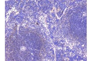 IHC analysis of PCDH15 using anti-PCDH15 antibody (ABIN6719362). (PCDH15 anticorps)