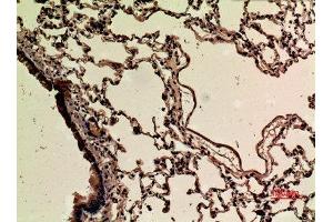 Immunohistochemistry (IHC) analysis of paraffin-embedded Rat Lung, antibody was diluted at 1:100.