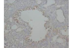 Immunohistochemical analysis of Paraffin-Embedded Rat Tissue Sections (Lung) using RAGE antibody. (RAGE anticorps  (Middle Region))