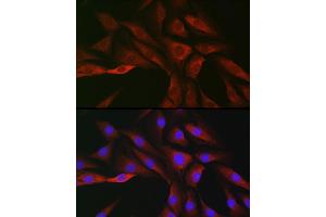 Immunofluorescence analysis of NIH/3T3 cells using SOCS3 Rabbit pAb (ABIN3021099, ABIN3021100, ABIN3021101 and ABIN6213950) at dilution of 1:50 (40x lens). (SOCS3 anticorps  (C-Term))