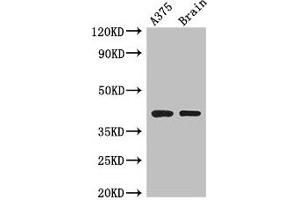 Western Blot Positive WB detected in: A375 whole cell lysate, Mouse brain tissue All lanes: SEPT12 antibody at 3. (Septin 12 anticorps  (AA 1-358))