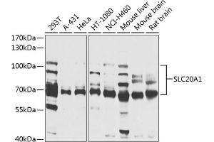 Western blot analysis of extracts of various cell lines, using SLC20 antibody (ABIN1682754, ABIN3018562, ABIN3018563 and ABIN6220499) at 1:1000 dilution. (SLC20A1 anticorps  (AA 257-356))