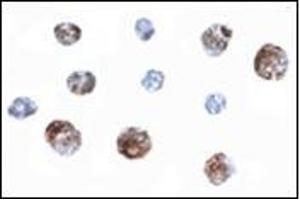 Immunocytochemistry of OTUD4 in Daudi cells with this product at 2.