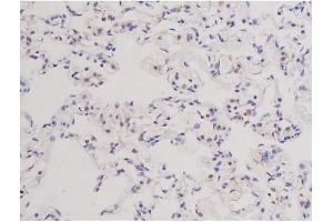 ABIN6266578 at 1/200 staining Rat lung tissue sections by IHC-P. (Ki-67 anticorps  (Internal Region))