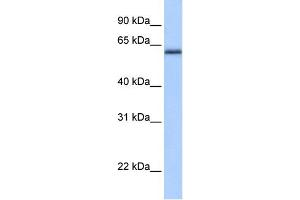 WB Suggested Anti-ZNF417 Antibody Titration:  0. (ZNF417 anticorps  (N-Term))