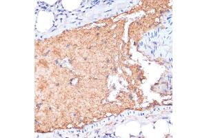 Immunohistochemistry of paraffin-embedded mouse lung using  antibody (ABIN6129926, ABIN6136997, ABIN6136998 and ABIN6218500) at dilution of 1:100 (40x lens). (APOA1 anticorps  (AA 25-267))
