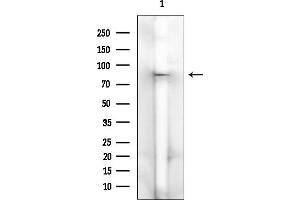 Western blot analysis of lysates from HUVEC cells(heat-shock treatment), using MDM4 Mouse Monoclonal Antibody at 1/1000 dilution.